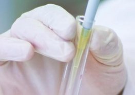 Aktuální nabídka infekčního oddělení pro pacienty s chronickou C-virovou hepatitidou