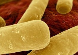 II. krajský mezioborový mikrobiologicko-infektologický seminář