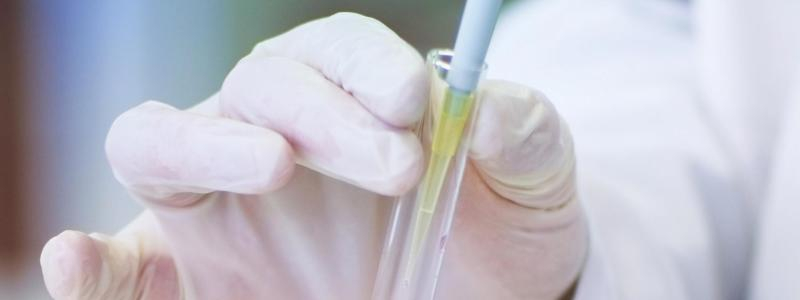 Aktuální nabídka infekčního oddělení pro pacienty s chronickou C-virovou hepatitidou