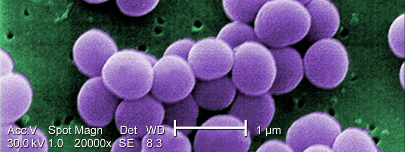 III. krajský mezioborový mikrobiologicko-infektologický seminář